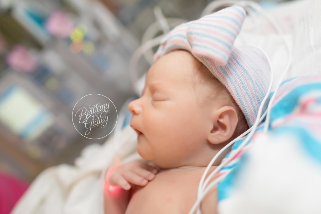 Congenital Heart Photographer | Congenital Heart Disease | Newborn Baby | PICU | Cleveland Clinic