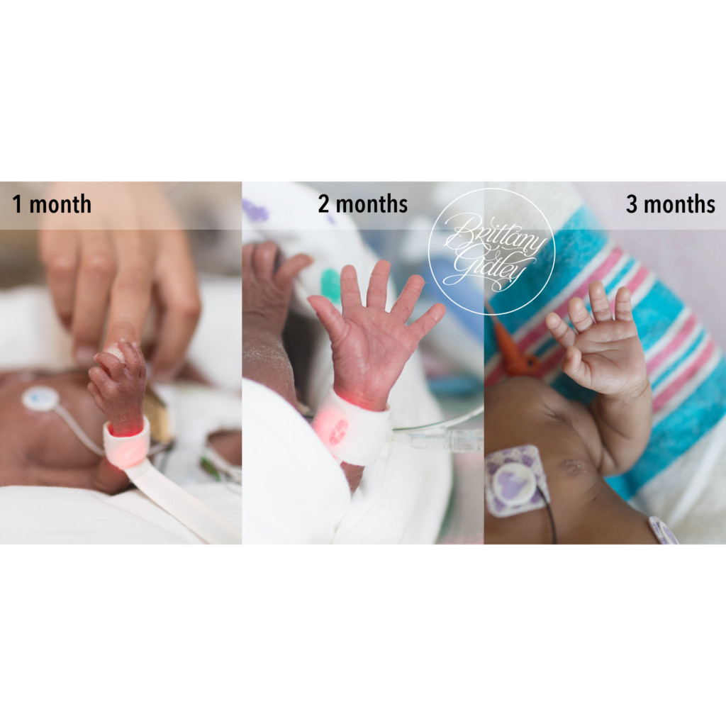 NICU Photographer | Photography Preemie Babies | NICU Images