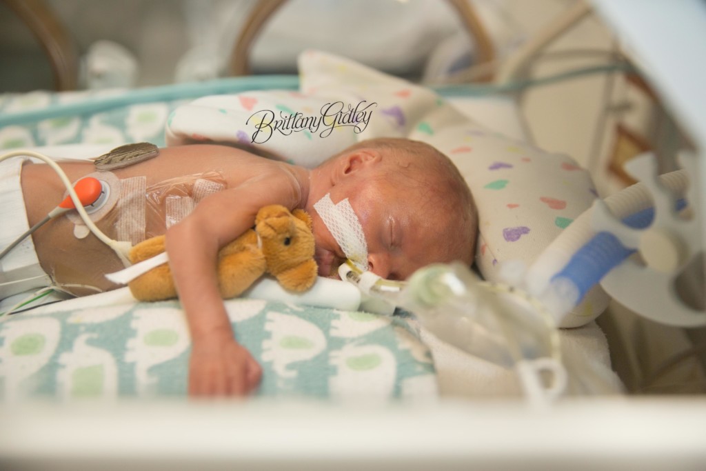 NICU Baby Photography | Preemie Photographer